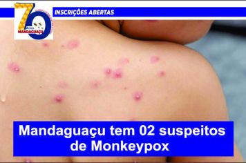 Mandaguaçu tem 02 suspeitos de Monkeypox
